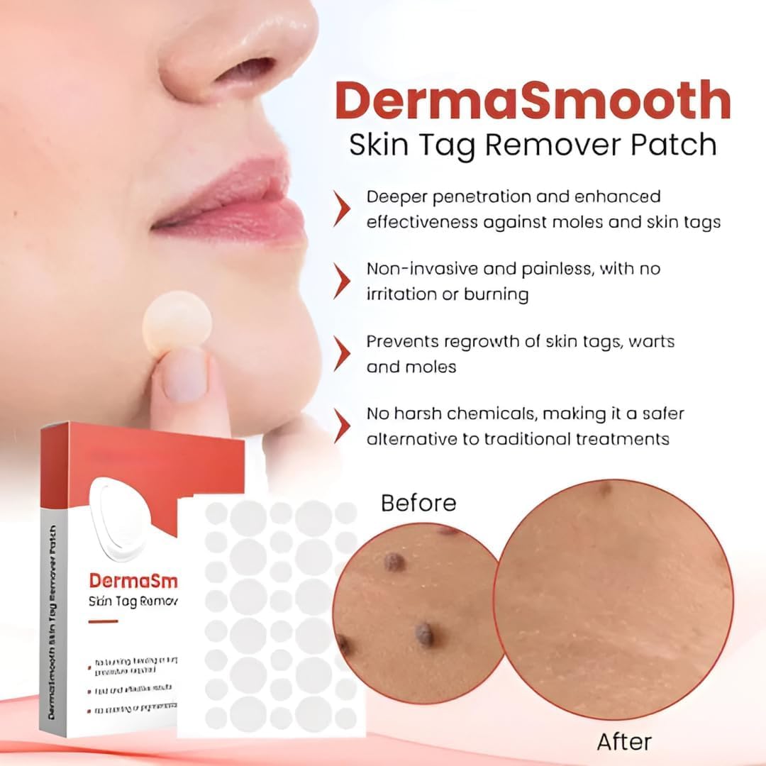 DermaSmooth Skin Care Patches – Gentle & Effective Skin Tag Remover for All Skin Types