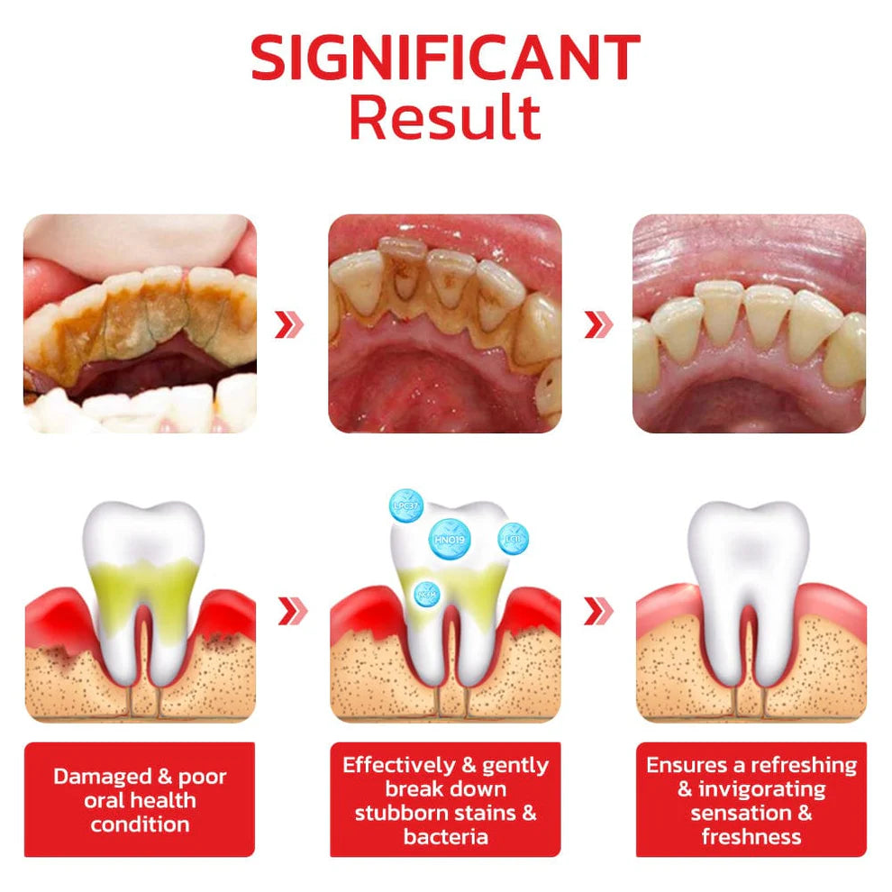 (Pack of 2) Probiotic Whitening Toothpaste